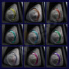 Tweeter 3D con iluminación para Mercedes clase C / GLC / E / S NV-SP8041 - Imagen 4